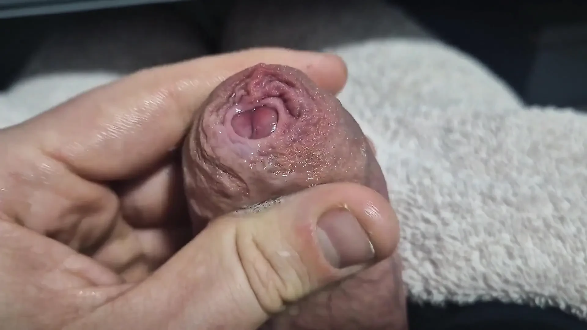Uncut Tight Phimosis Cock Foreskin Stretched Close up