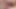 476 PAM AMATRICE ANAL