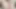 Clamped My Big Clitoris and Masturbated to a Pulsating Orgasm