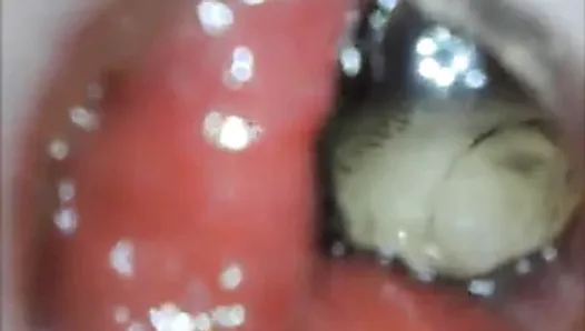 anal endoscope ass play from inside