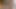 Guy With Cerebral Palsy Has A Massive Explosion Of CUM From His Big Dick
