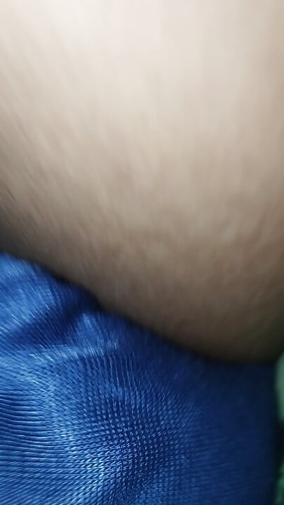 Acne on my penis I want to clean it up
