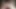 Long foreskin movement (slowmotion) 448