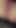 Unforgettable moment from "Cute German Teen get Tickled and stimulated to intense Orgasm in Gyno Chair"