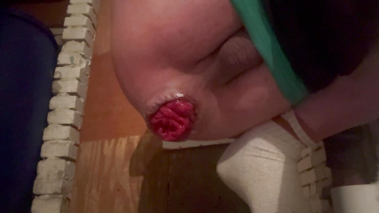 my ass really likes dildos and how it falls out prolapsing 2