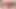 Lesbian anal sex