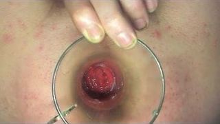 肛门前列腺插入 pluviometer