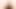Etli vulva'mın arka görünümü