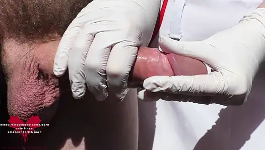 Медицинская стимуляция пениса