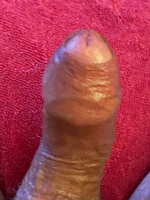 Penis pompalama