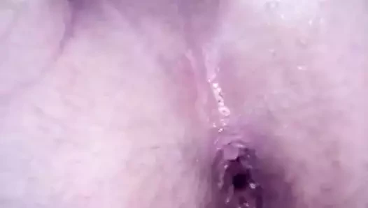 anal