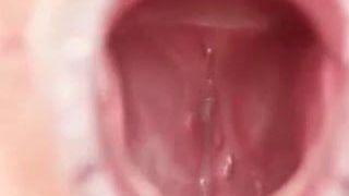 Secreción vaginal