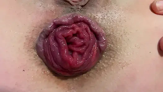 Spreizen und prolaps mein arschloch in nahaufnahme