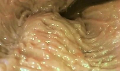 Sex