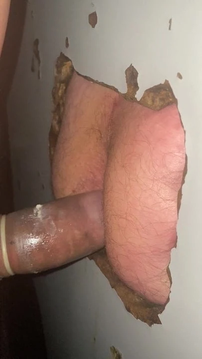 Besleme zafer deliği