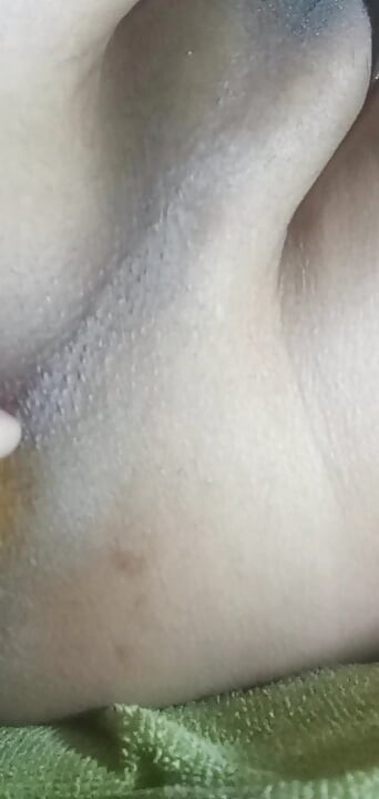 Hands-Free Anal Masturbation, Small Prolapse and Shoeing