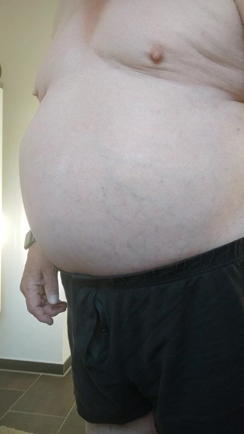New marks on my ass