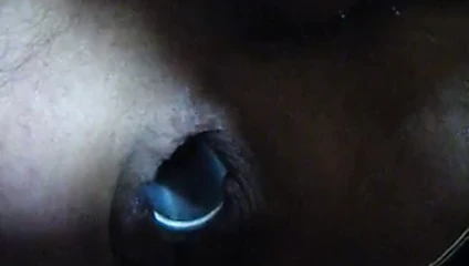 anal germe