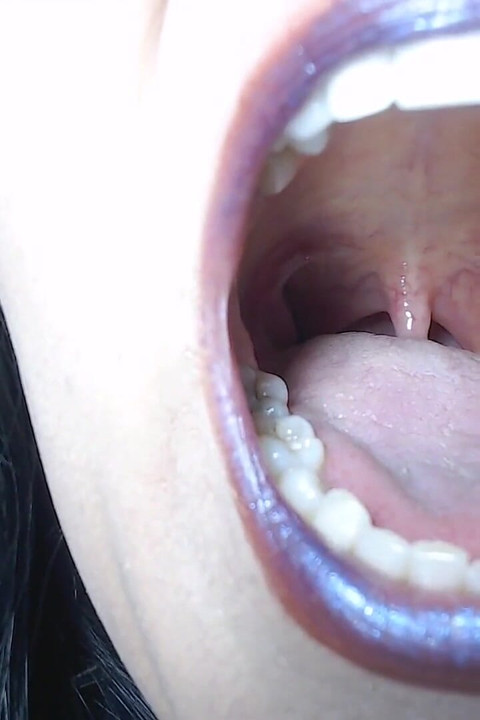 Deep Inside Tongue Teeth Uvula Throat