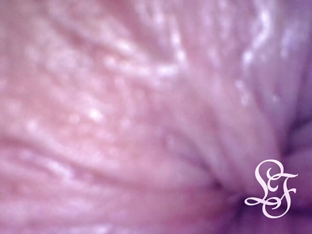 Look inside my ass while I'm getting an enema!