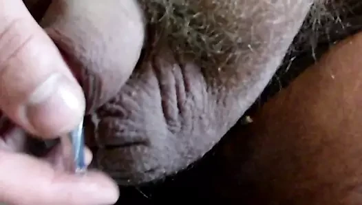 Fisting penis sondaj penis