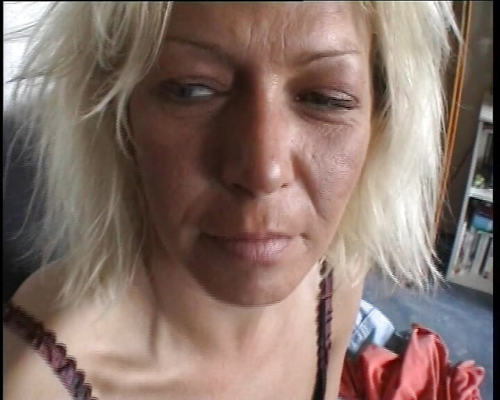 Se Lo Llevaron a Casa Y Le Dieron Un Tirón En La Cara