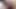 A MILF Girl Had Her Ass Stretched by a Man with a Very Large Penis.