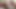 Balls and foreskin - 4 of 6 - egg #2