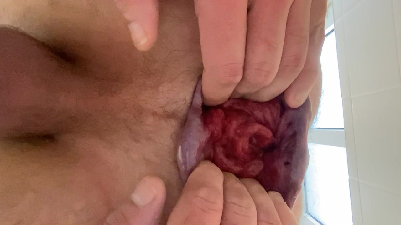 素晴らしいアナルギャップと巨大なバラ!