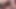 ホリー・キス・スパンク・ドクター