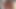 エボニーの継姉妹が私のペニスを使ってアナル - レイン・カーター - アナルセラピー - アレックス・アダムス
