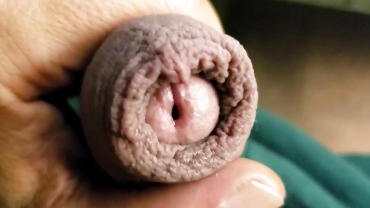 アルファキャッシュコック包皮!