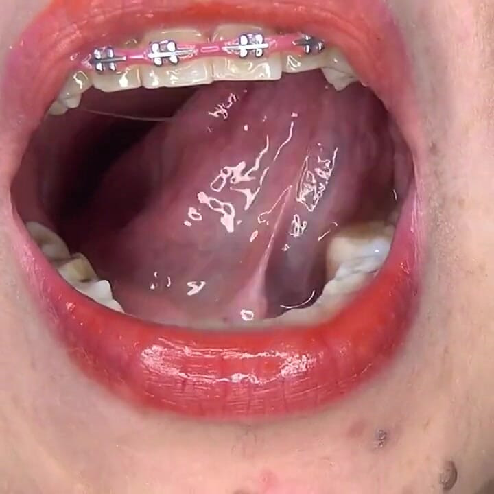 Swallowing Large Gummy Bears, Putting Them in the Vagina