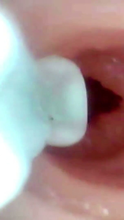 A detailed examination of Lopuza93 oral cavity and anal area using an endoscope camera. | Clip 3