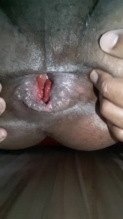 Anal  Deep intruding