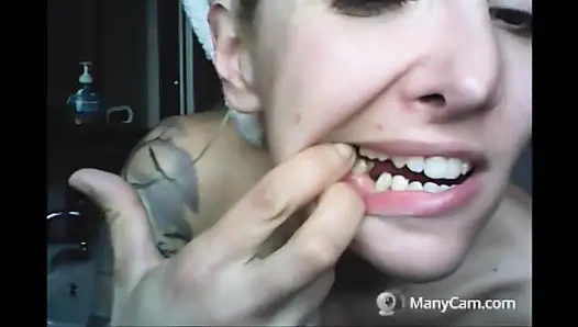 Chantal'ın dişleri çürümüş ve siyah dökülüyor