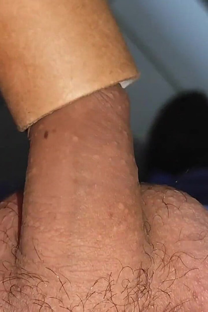 Oštrenje penisa glavića tekućim ljepilom.