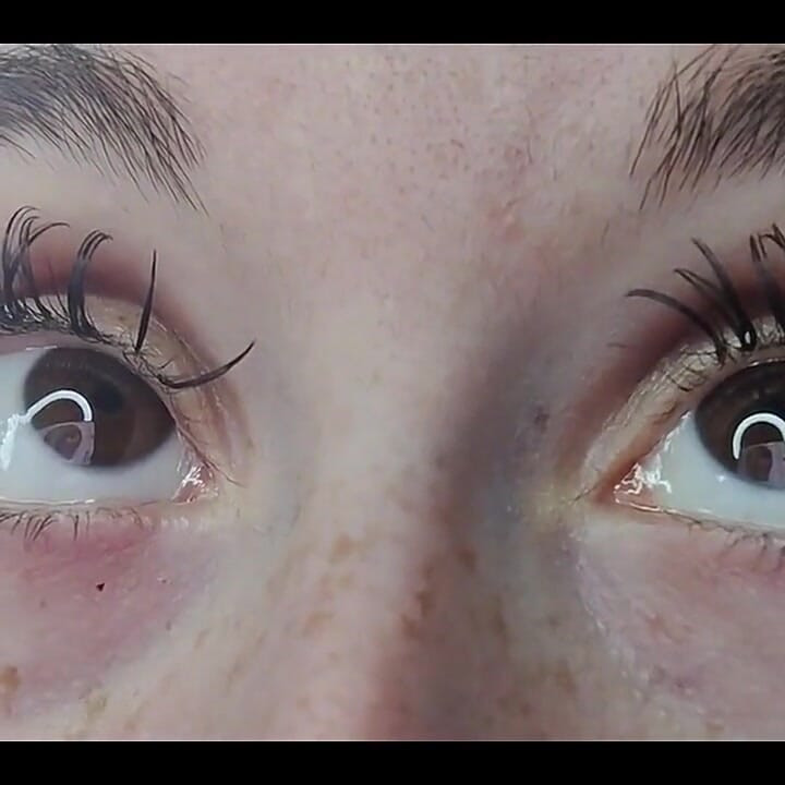 Crossing the Eyes