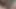 Parmağını çimdikliyor ve işiyor