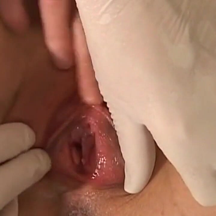 Insatiable Mature Patient Drained in Medical Exam Chair