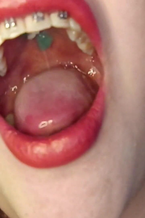 Consume Chews Gummies