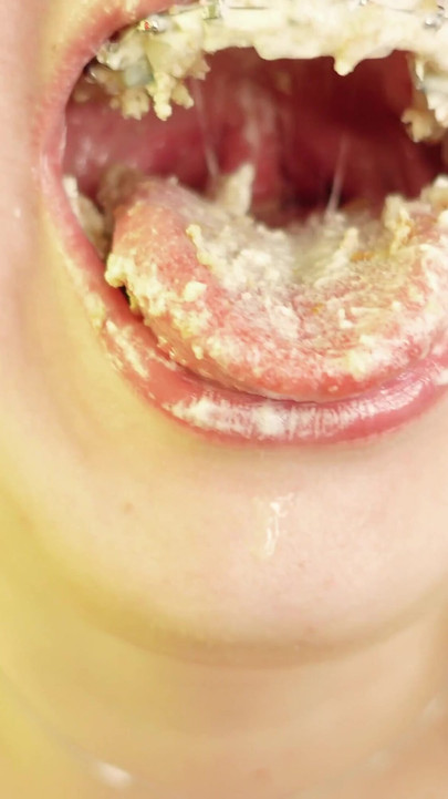Epic moment from "eating in braces - vore and food fetish - close up video"