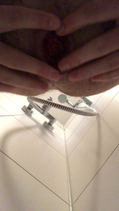 Prolapse ass