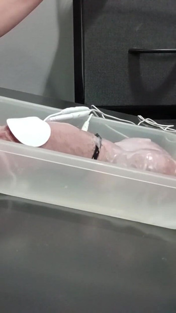 来自“蜡和 2b estim 射液”的迷人时刻