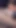 Stunning moment from "Ugly german blue hair stripper girl get anal fuck backstage"