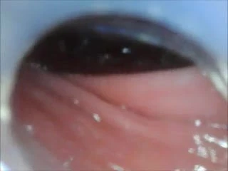 anal endoscope ass play water condom
