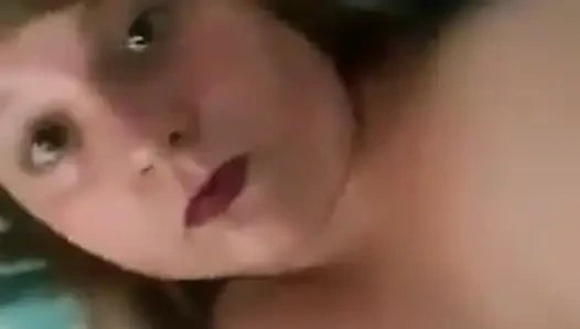 Ampute kız vücudunu gösteriyor