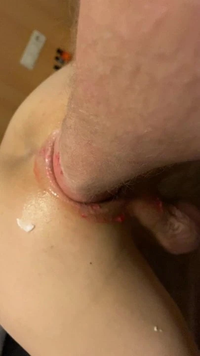 Deep fisting. Gaping