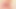 Tiny erect penis