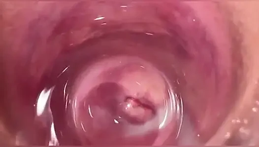 Camera in Vagina, Cervix POV, Creampie